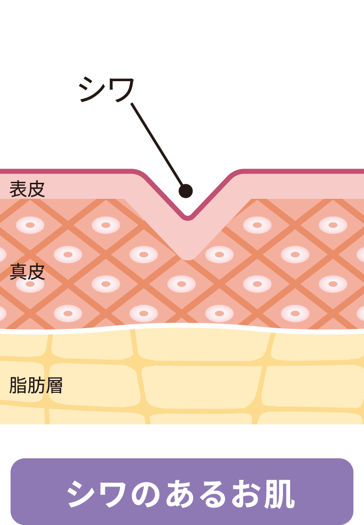 1.シワのあるお肌