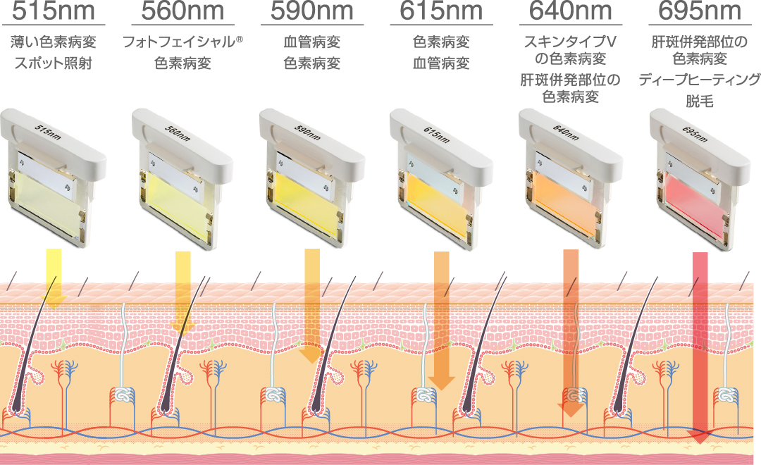 波長域を変換し、肌状態に応じた治療が可能。