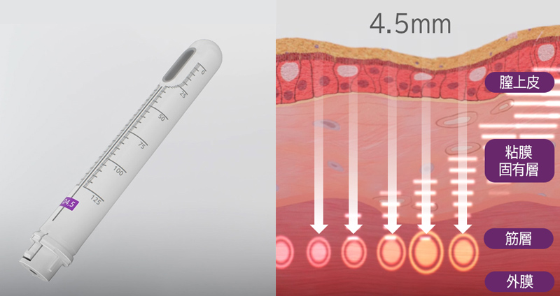膣壁の深層（筋膜層）にアプローチし、特に引き締め効果をサポートします。