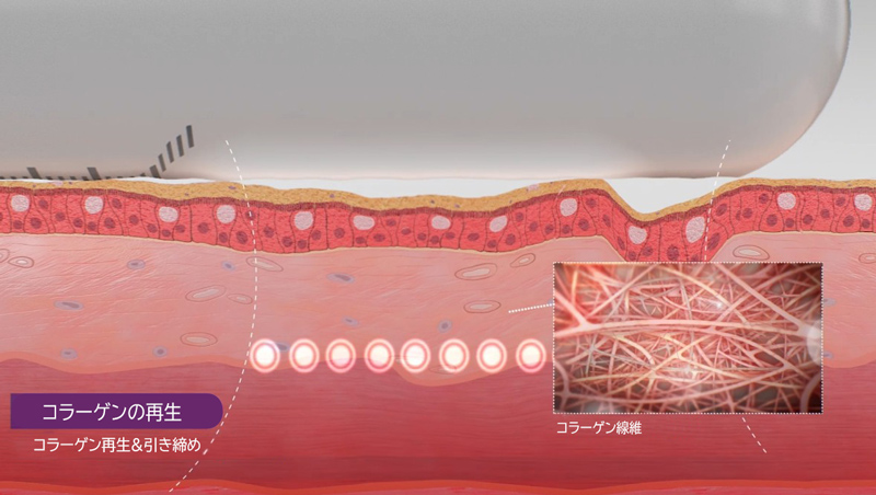 ウルトラヴェラの仕組み