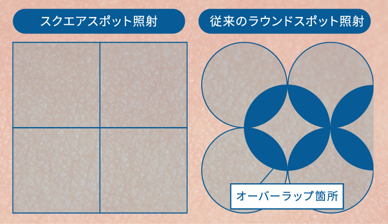 27mmスクエアスポット照射